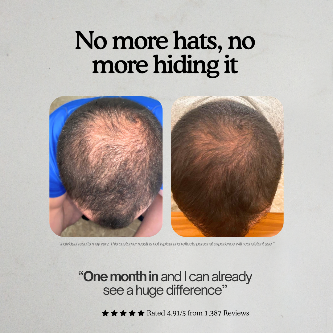 RECLAIM Advanced Hair Growth Formula