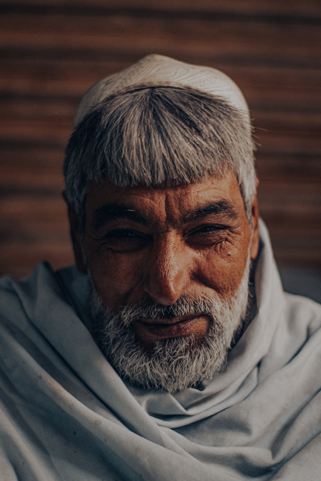 Older man considering a hair transplant